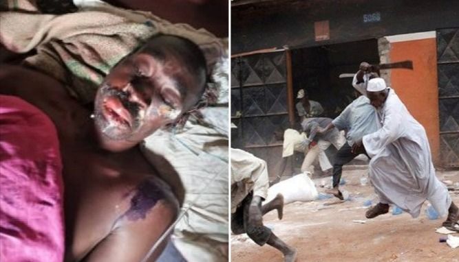 Pastor é pulverizado com ácido por extremistas muçulmanos em Uganda